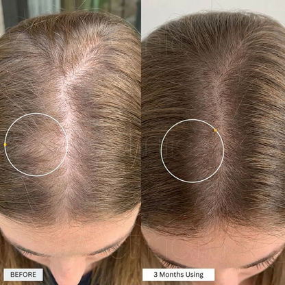 SheRise™ PCOS Hair Spray